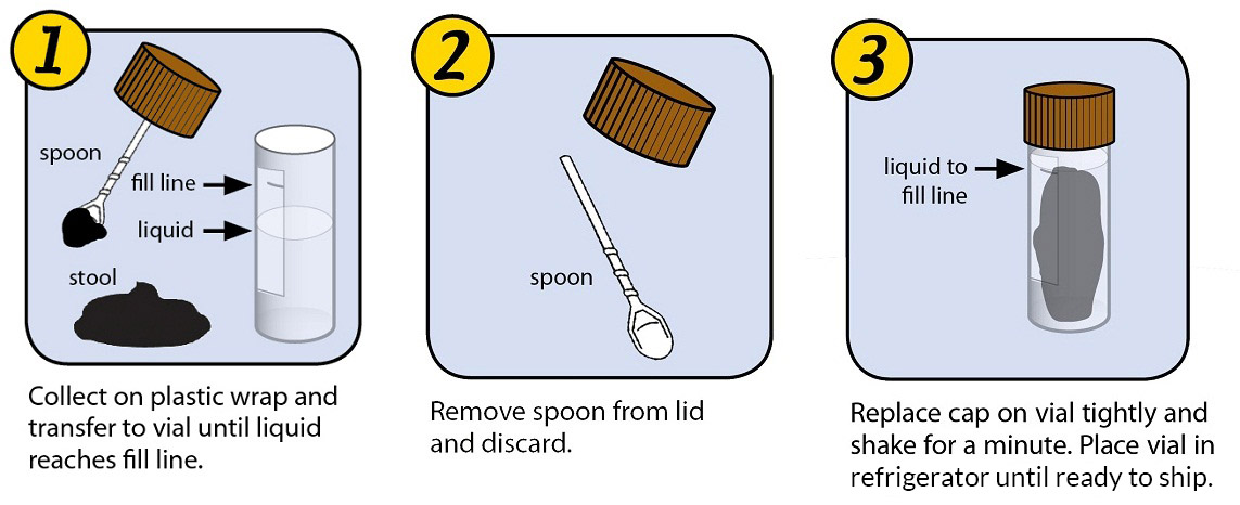 what do stool samples test for