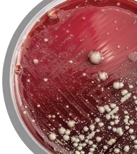 Bacterial Stool Culture Plate