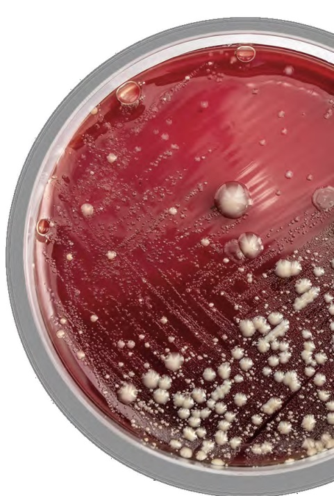 bacterial culture