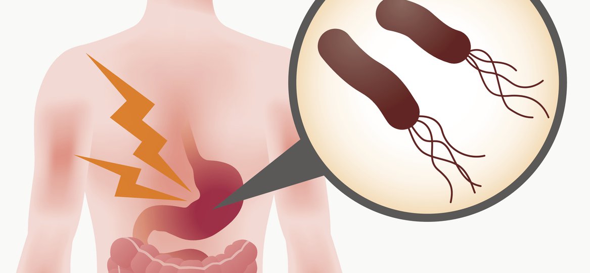 Helicobacter pylori - Human Stomach