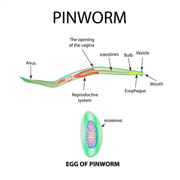 pinworms kiütés a testen