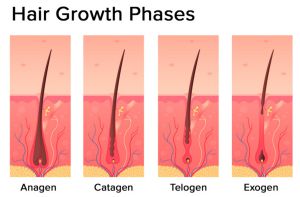 Cortisol Stress Hormonal Imbalances and Hair Loss Growth