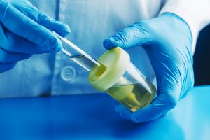 The Toxic Effects of Lead Exposure on Bone Health Best Heavy Metals Test