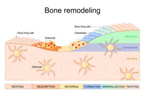 The Toxic Effects of Lead Exposure on Bone Health Best Heavy Metals Test