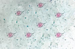 Giardia lamblia trophozoite in stool specimen analysed by microscope. Medical parasitological test close up image.