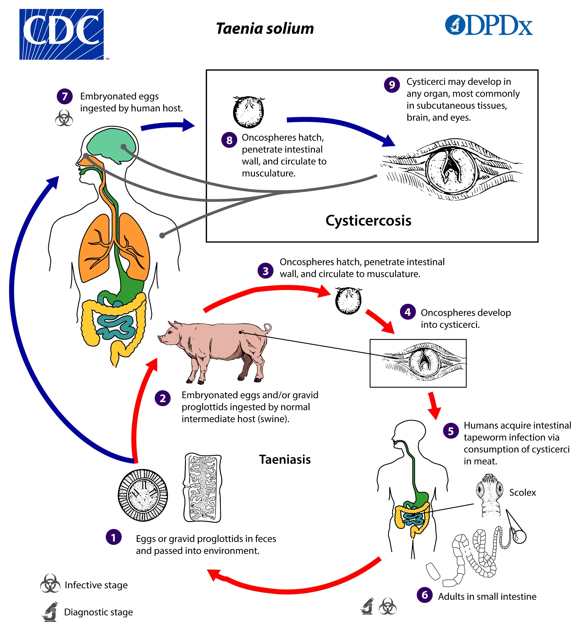 Tapeworm (Taenia solium) Infection - Symptoms, Diagnosis & Treatment Test for Taeniasis, Cysticercosis, and Neurocysticercosis (NCC)