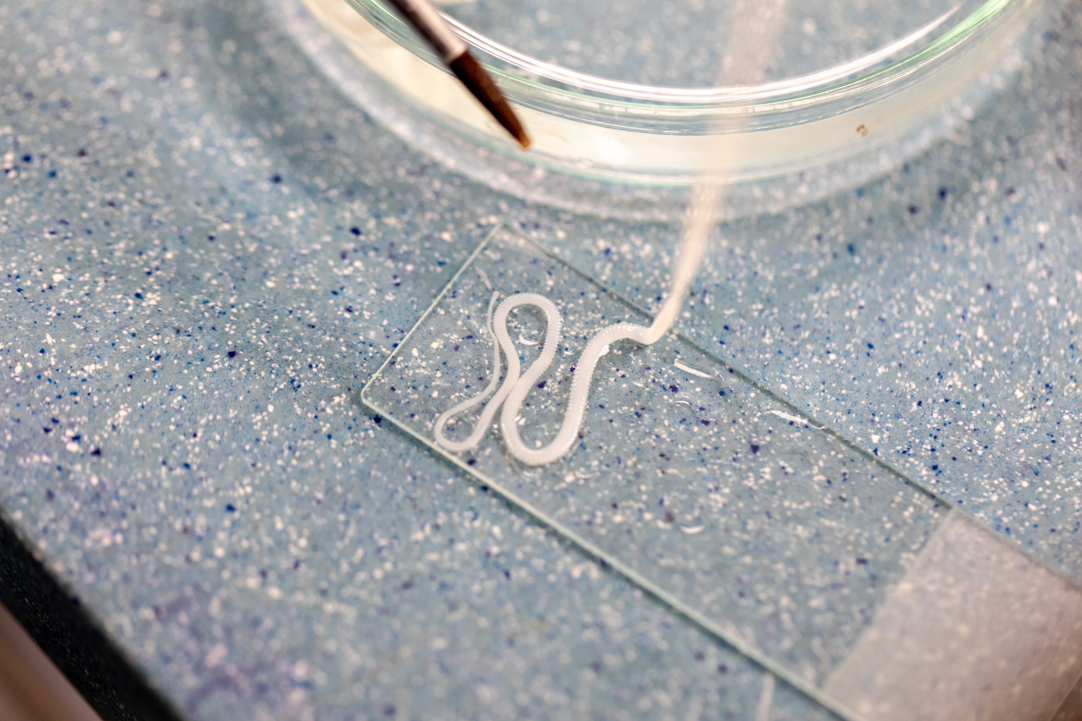 Tapeworm (Taenia solium) Infection - Symptoms, Diagnosis & Treatment Test for Taeniasis, Cysticercosis, and Neurocysticercosis (NCC)