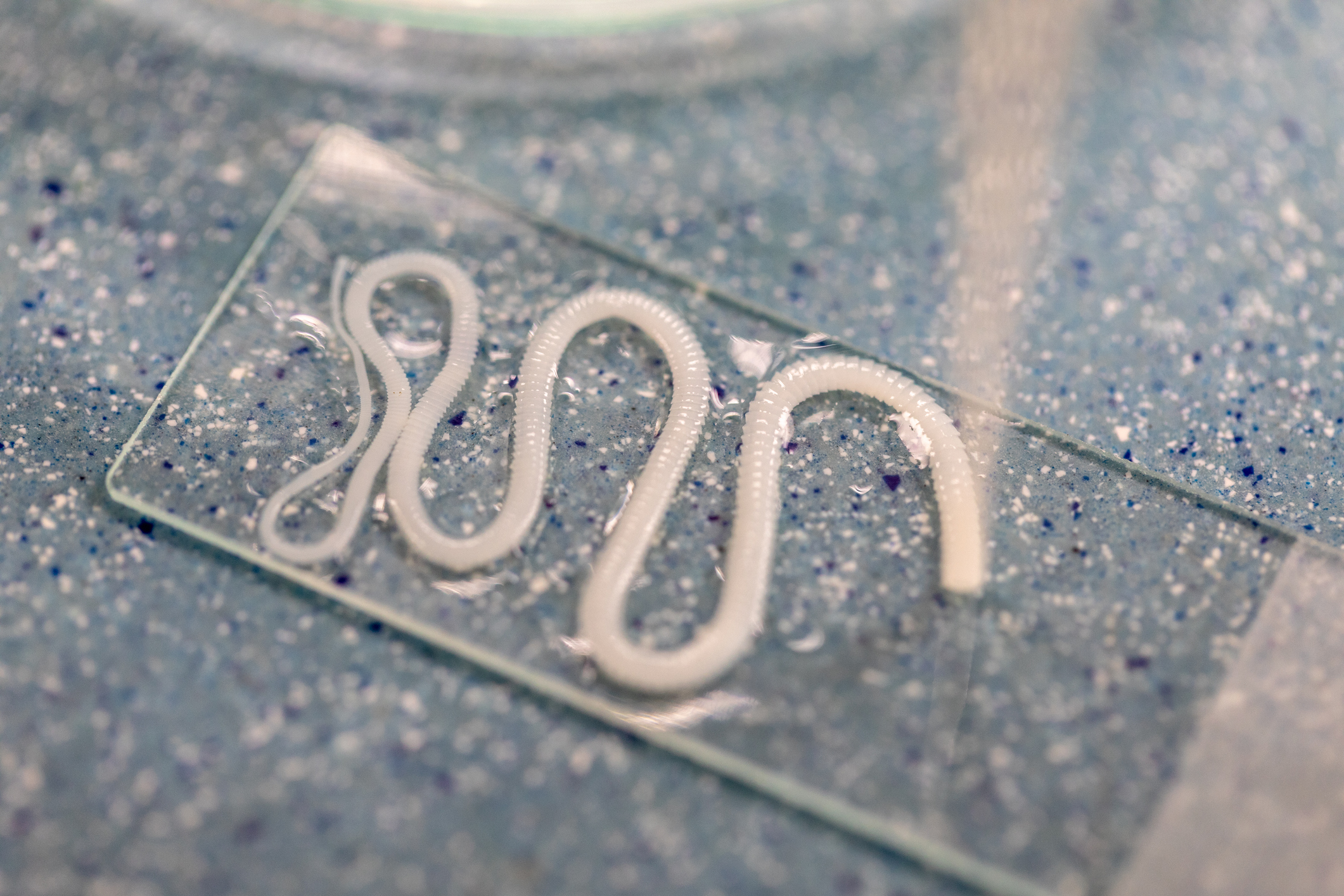 Tapeworm (Taenia solium) Infection - Cysticercosis Symptoms