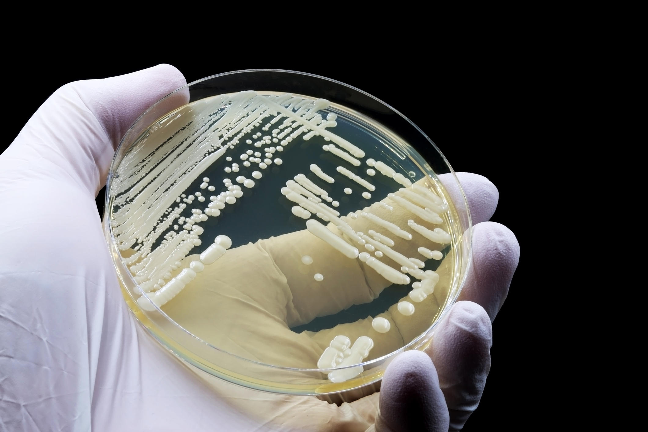 Natural Antifungal Herbs for Candida Overgrowth (Candidiasis) Treatment Thrush Vulvo-vaginal Candida